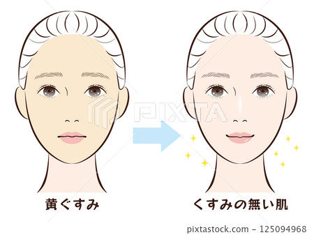 Before and after from dull yellow skin to clear skin 125094968