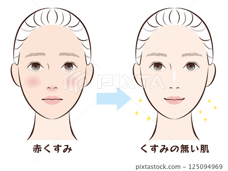 Before and after from red dull skin to clear skin Before and after from red dull skin to clear skin 125094969