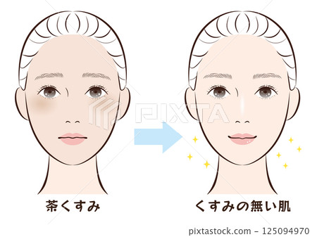 膚色由暗黃變白至透亮的前後對比 125094970