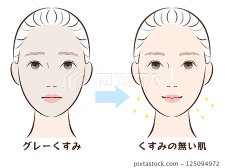 Before and after from grey dull skin to clear skin 125094972