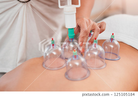 Spa, physiotherapy and cupping therapy with back of woman for relax, massage and beauty. Health, alternative medicine and holistic treatment with hands of therapist for healing, zen and wellness 125105184