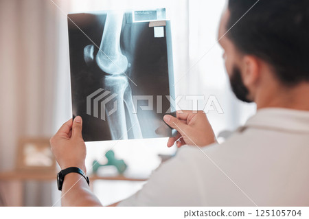 Health, x ray and physiotherapy, man physiotherapist check medical results from injury, broken bone and healthcare. Physio, wellness and medicine, rehabilitation in health care and xray scan. 125105704