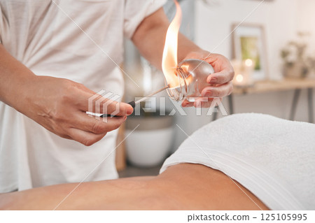 Spa, cupping therapy and flame to relax, stress and tension release. Alternative medicine, wellness and suction cup for relief treatment, healing back pain and help with blood flow and inflammation. 125105995