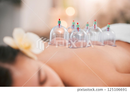 Cupping therapy, spa and zen woman for chinese alternative medicine treatment for back pain and health. Bodycare and wellness with cup therapy for stress relief, wellbeing wiith cups and heat on skin 125106691