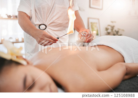 Relax, luxury and woman in cupping therapy for back pain or muscle injury sleeping in peace for physiotherapy. Fire, heating and girl customer with physiotherapist in physical therapy for healing 125108988