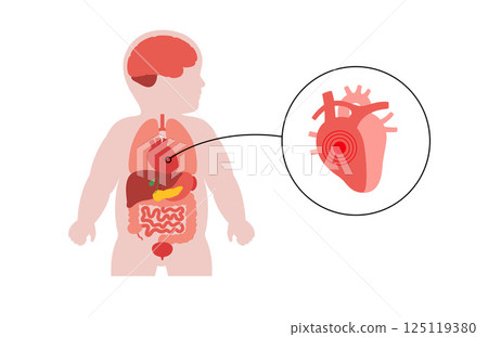 Heart disease in a child 125119380