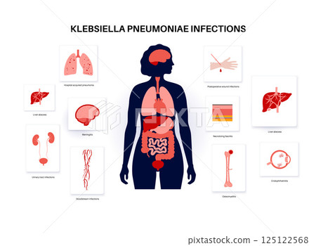 Klebsiella pneumoniae poster 125122568