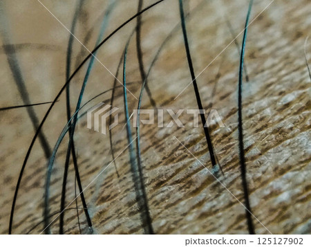 Hair Analysis in Forensic Science 125127902