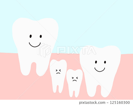 牙齒之間：阻生牙齒和多生牙的插圖：牙齒問題的特徵 125160300