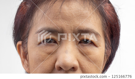Flabby and wrinkled skin on senior woman face. 125166776