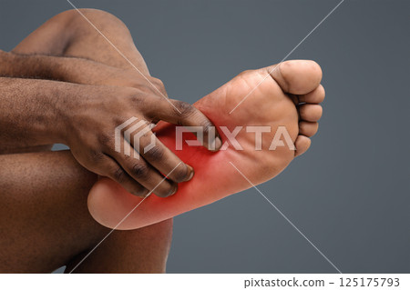 Afro man scratching bare foot, Athlete's foot syndrom, common skin infection caused by fungus, cropped Afro man scratching bare foot, Athlete's foot syndrom, common skin infection caused by fungus, cropped 125175793
