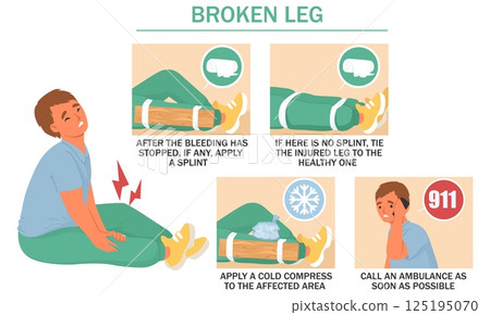 Clear instructions are provided for treating a broken leg, including applying a splint, using a cold compress, and calling for emergency assistance promptly 125195070