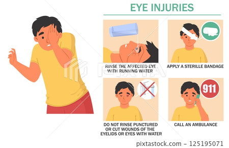 Rinse the affected eye with water, apply a sterile bandage, and call for emergency help if needed. Learn important first aid procedures for eye injuries effectively Rinse the affected eye with water, apply a sterile bandage, and call for emergency help if needed. Learn important first aid procedures for eye injuries effectively 125195071