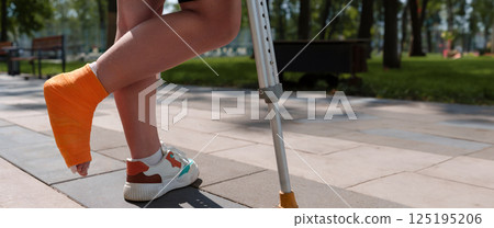 Detailed shot of a lower limb in a bright orange plaster cast, alongside crutches in the out-of-focus setting of a verdant park Detailed shot of a lower limb in a bright orange plaster cast, alongside crutches in the out-of-focus setting of a verdant park 125195206