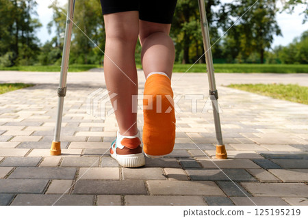 Close-up of a teenager's legs in an orange cast walking along a summer parkway leaning on metal crutches 125195219