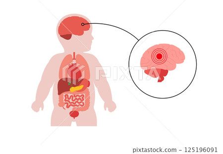 Brain diseases in a child 125196091