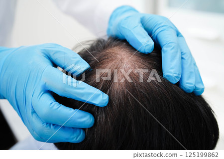 Doctor touch bold head in man, hair loss treatment health problem. Doctor touch bold head in man, hair loss treatment health problem. 125199862