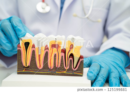 Dentist holding dental implant, artificial tooth roots into jaw, root canal of dental treatment, gum disease, teeth model for dentist. 125199881
