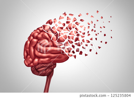 Alzheimers Concept Alzheimers Concept 125235804