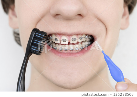 Young man with dental braces holding brushes for cleaning his teeth. 125258503