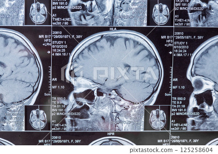 Magnetic resonance imaging or MRI image of the brain 125258604