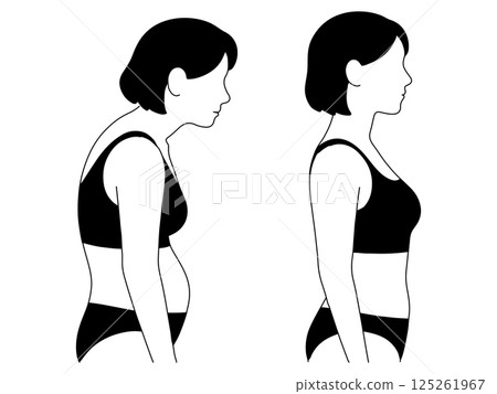 駝背與正確姿勢對比 125261967