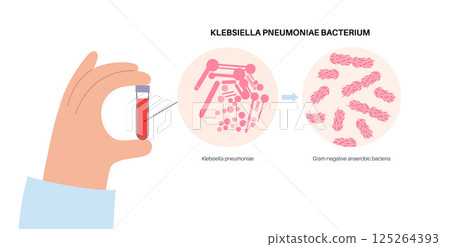 Klebsiella pneumoniae poster 125264393