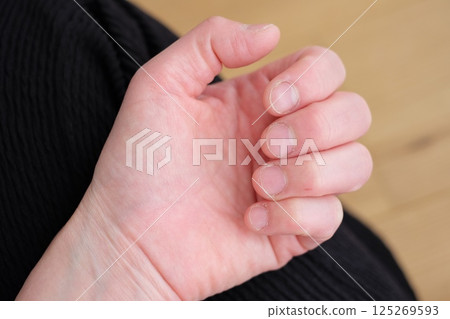 40多歲女人左手 125269593