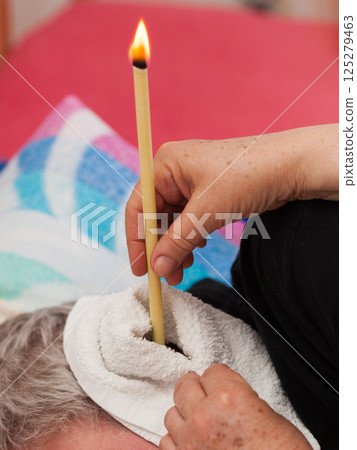 Terapist doing ear candling treatment Terapist doing ear candling treatment 125279463