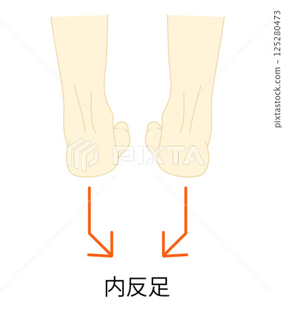 馬蹄足的插圖 125280473