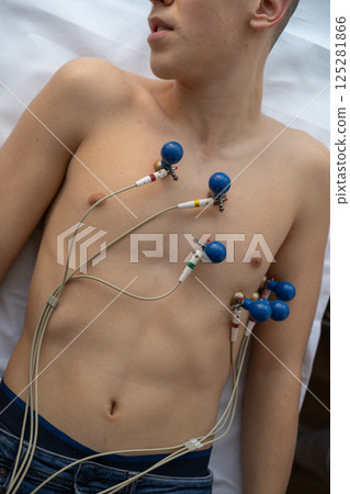 A female doctor performs an ECG on a young man in a hospital room, carefully monitoring his heart health during a routine checkup. 125281866