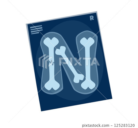 Healthcare cartoon font bones X-ray letter N. Healthcare kids ABC typeface sign, medical cartoon isolated vector typeset symbol. Hospital font letter or medicine English alphabet type element Healthcare cartoon font bones X-ray letter N. Healthcare kids ABC typeface sign, medical cartoon isolated vector typeset symbol. Hospital font letter or medicine English alphabet type element 125283120