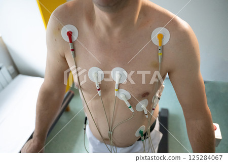 A middle-aged man is undergoing a medical stress test on a treadmill, connected to ECG electrodes for heart monitoring in a clinical environment 125284067