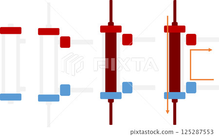 Dialysis illustration 125287553
