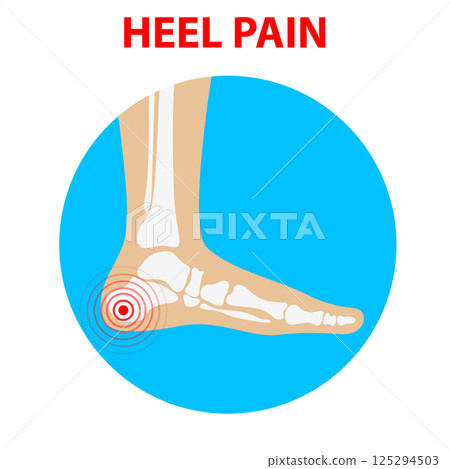 Heel pain. Human ankle joint icon back view. Vector illustration. 125294503