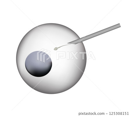 Artificial insemination injecting sperm into female egg cell Artificial insemination injecting sperm into female egg cell 125308151