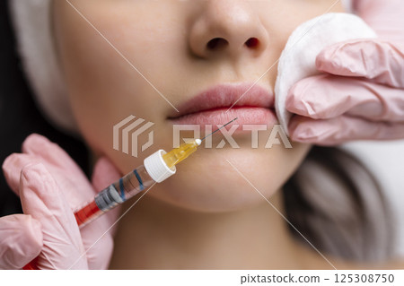lip shape correction procedure in a cosmetology salon. The specialist makes an injection on the lips of the patient. Lip augmentation. lip shape correction procedure in a cosmetology salon. The specialist makes an injection on the lips of the patient. Lip augmentation. 125308750