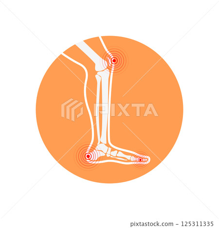 Human leg pain zones. Design elements for infographic. Vector illustration. 125311335