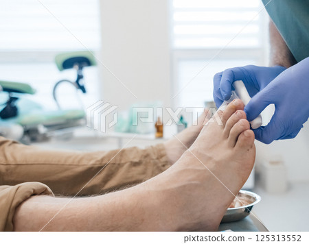 Resection of the nail plate, removal of ingrown nail. Dressing after surgery on the toe. Surgical treatment of onychocryptosis, paronychia and purulent disease 125313552