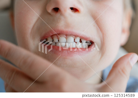 Childs mouth close-up with a finger pointing at a loose tooth, highlighting dental growth and development. Captures the curiosity and excitement of a child 4 Year old losing a baby tooth.  125314589