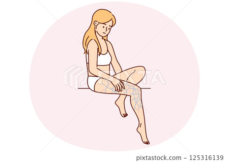 Upset woman in lingerie looks in bewilderment at leg with swollen veins after unsuccessful walk 125316139