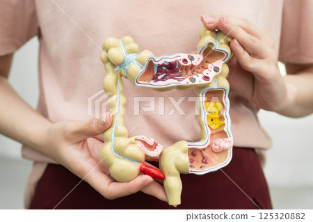 Intestine, Asian woman holding human anatomy model. Intestine, Asian woman holding human anatomy model. 125320882