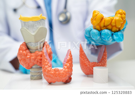 Hyperthyroidism, Overactive Thyroid, Thyroid Lymphoma, Asian doctor with thyroid gland human anatomy model in hospital. 125320883