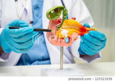 Pancreatitis, pancreatic cancer, Asian doctor with pancreas, gallbladder and bile duct human anatomy model at hospital. Pancreatitis, pancreatic cancer, Asian doctor with pancreas, gallbladder and bile duct human anatomy model at hospital. 125321036