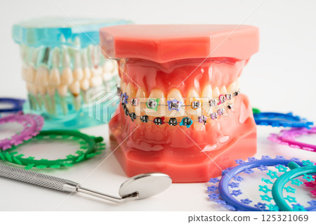 Orthodontic ligatures rings and ties, elastic rubber bands on orthodontic braces, model for dentist studying about dentistry. Orthodontic ligatures rings and ties, elastic rubber bands on orthodontic braces, model for dentist studying about dentistry. 125321069