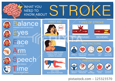 Brain stroke infographics vector isolated 125323570