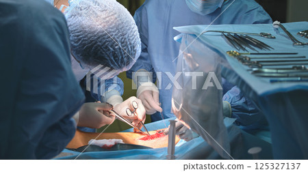 Team of surgery doctors operating a patient in surgical room. Healthcare and medical aid concept Team of surgery doctors operating a patient in surgical room. Healthcare and medical aid concept 125327137