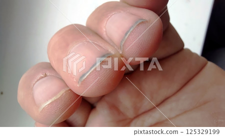 Hand shows dirt and grime under fingernails after outdoor work without gloves in the early afternoon 125329199