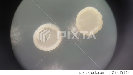 在立體顯微鏡下觀察黴菌和細菌菌落 125335144