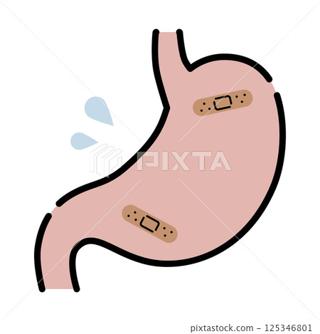 Illustration of a weak stomach 125346801